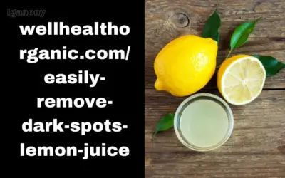 wellhealthorganic.com/easily-remove-dark-spots-lemon-juice